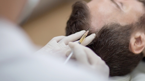 Cơ chế hoạt động và điểm nổi bật giúp tiêm PRP tóc được tin chọn