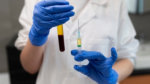 Vai trò của tiểu cầu trong phương pháp tiêm huyết tương giàu tiểu cầu