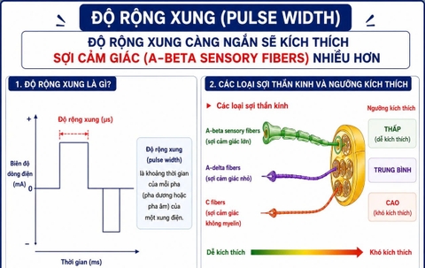 ĐỪNG QUÊN ĐIỀU CHỈNH ĐỘ RỘNG XUNG TRONG ĐIỆN XUNG ĐỂ TĂNG HIỆU QUẢ ĐIỀU TRỊ