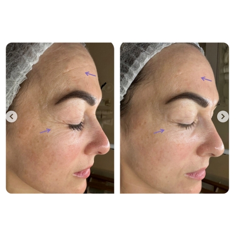 CHRISTINA NUANCE: Giải Pháp Trẻ Hóa Sinh Học Độc Quyền Tái Cấu Trúc ECM