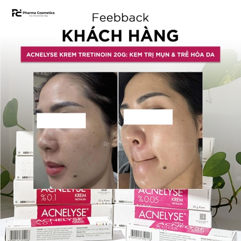 ACNELYSE KREM TRETINOIN 20G: Kem Trị Mụn & Trẻ Hóa Da