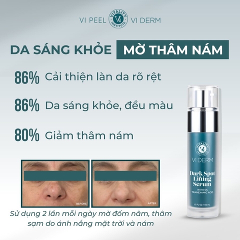 VI DERM DARK SPOT LIFTING SERUM: Tinh Chất Làm Mờ Thâm Nám, Dưỡng Da Sáng & Đều Màu