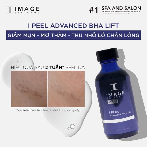 ADVANCED BHA ĐẶC TRỊ MỤN: Giải Pháp Chuyên Sâu Cho Da Dầu & Mụn Cấp Độ Nặng