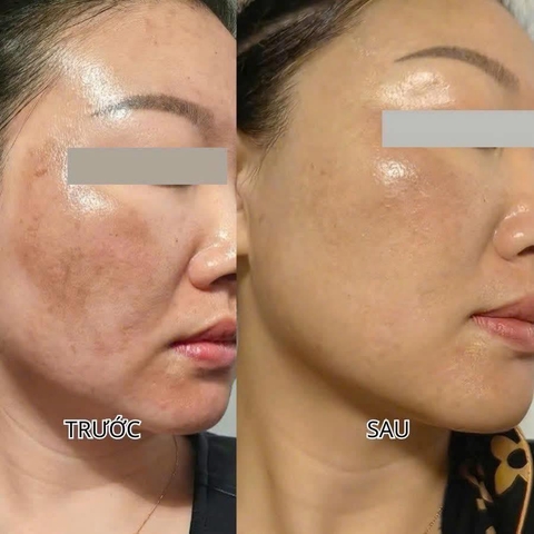 CASMARA CLARIFYING CONCENTRATED SERUM / SERUM DƯỠNG TRẮNG, MỜ NÁM BAN ĐÊM 