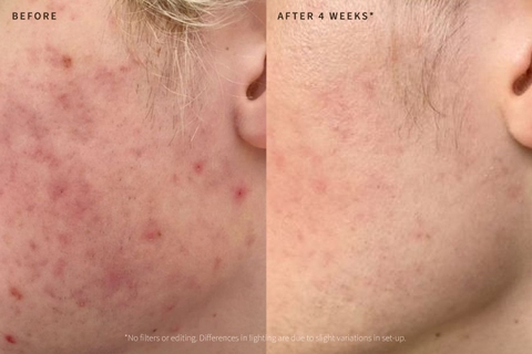 PHARMAFORM PRE & POSTBIOTICS SYNERGY SERUM: Tinh Chất Phục Hồi & Tăng Cường Sức Đề Kháng Da