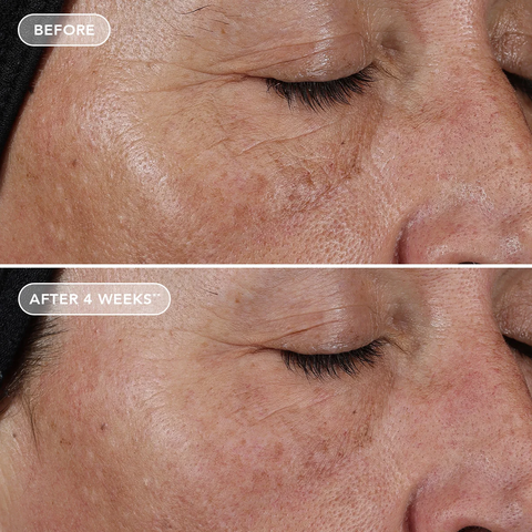 IMAGE Skincare AGELESS+ Retinol Pure Liquid Retinol 0.1%: Serum retinol tinh khiết 0.1% dành cho người mới bắt đầu, da nhạy cảm hoặc da hỗ hợp.