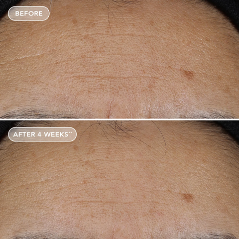 IMAGE Skincare AGELESS+ Retinol Repair Crème 0.3% Retinol Complex – Kem dưỡng retinol làm sáng và chống lão hóa cho người mới bắt đầu, da nhạy cảm, da khô.