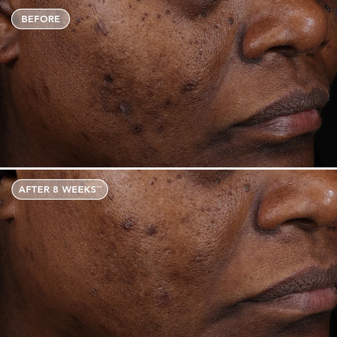IMAGE Skincare AGELESS+ Retinol Treatment Crème 1.2% Retinol Complex – Kem retinol nồng độ cao chống lão hóa chuyên sâu