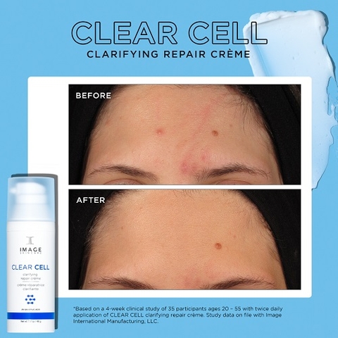 CLEAR CELL CLARIFYING REPAIR CRÈME / KEM KIỂM SOÁT MỤN VÀ ĐIỀU TIẾT NHỜN CHỨA CERAMIDE, BAKUCHIOL VÀ 2% SALICYLIC ACID