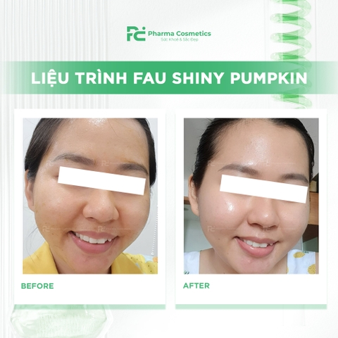 FAU SHINY PUMPKIN: Liệu Pháp Peel Enzyme Bí Đỏ Trẻ Hóa & Tái Tạo Cấu Trúc Da