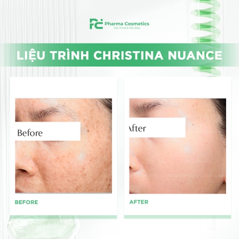 CHRISTINA NUANCE: Giải Pháp Trẻ Hóa Sinh Học Độc Quyền Tái Cấu Trúc ECM