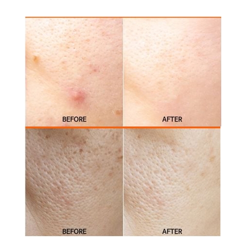 FAU SHINY PUMPKIN: Liệu Pháp Peel Enzyme Bí Đỏ Trẻ Hóa & Tái Tạo Cấu Trúc Da