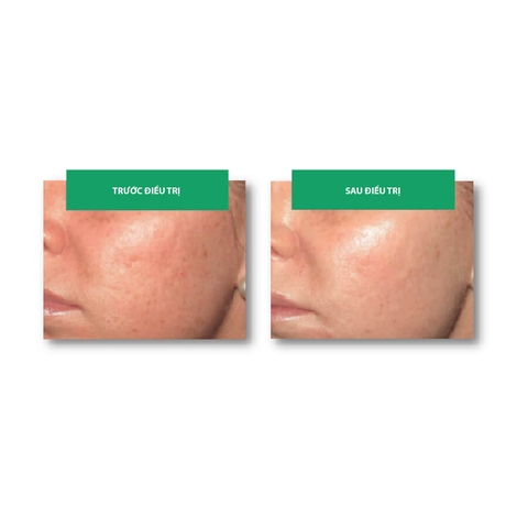 Md:cocktail SkinBooster Anti-Pollution Defence – Tinh Chất Phục Hồi & Chống Ô Nhiễm Đa Tầng