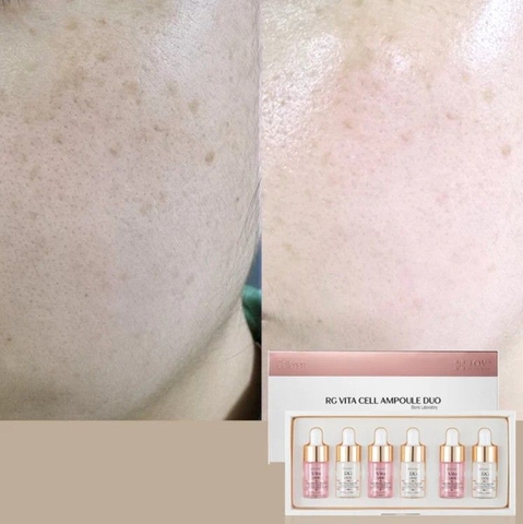 ORGAHUE RG VITA CELL AMPOULE DUO / BỘ ĐÔI TINH CHẤT TRẺ HÓA TRẮNG DA
