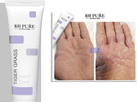 KB PURE TIGER GRASS: Kem Dưỡng Hỗ Trợ Phục Hồi & Chăm Sóc Da Tay Toàn Diện
