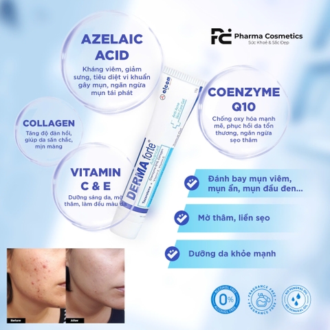 ALCOM DERMA FORTE AZELAIC ACID 20% / GEL TRỊ MỤN, MỜ THÂM, SÁNG DA