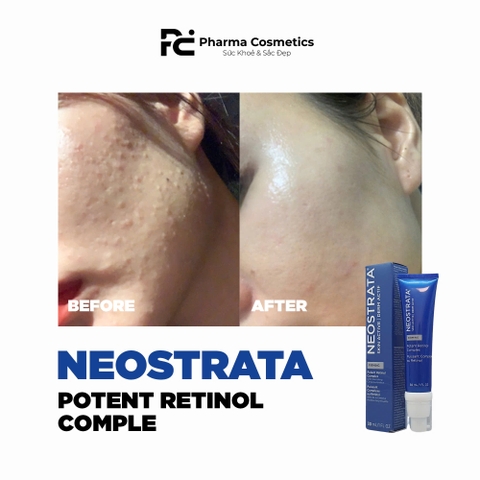 NEOSTRATA SKIN ACTIVE POTENT RETINOL COMPLEX / KEM DƯỠNG CHỐNG LÃO HÓA
