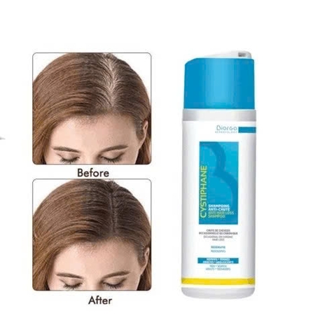 Bailleul Cystiphane Shampooing Antichute: Dầu Gội Ngăn Rụng Tóc Chuyên Biệt Từ Pháp
