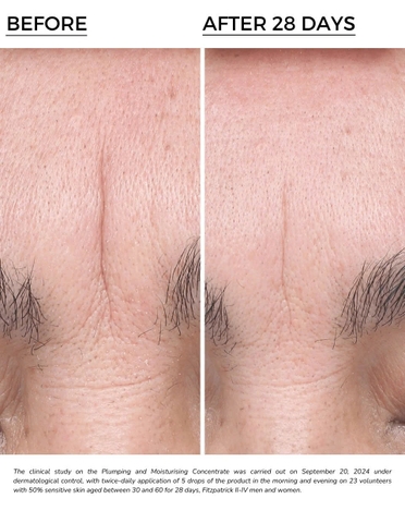 DERMEDEN DERMEDEN HYAL-FILLER PLUMPING AND MOISTURISING CONCENTRATE 15% : Tinh Chất Dưỡng Ẩm Đa Tầng & Hiệu Ứng Làm Đầy Tức Thì