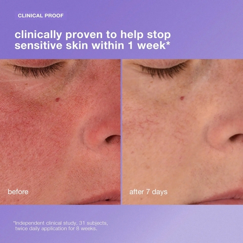 DERMALOGICA STABILIZING REPAIR CREAM: Kem Dưỡng Phục Hồi - Làm Dịu & Tăng Cường Sức Mạnh Làn Da Nhạy Cảm