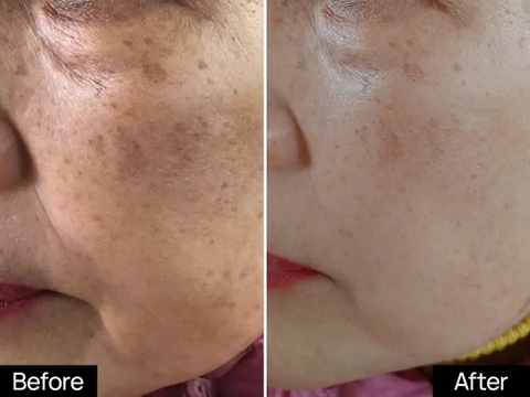 GSC MELA BRIGHT SPOT CORRECTOR: Kem Dưỡng Mờ Thâm Nám - Phục Hồi & Bảo Vệ Toàn Diện Cho Làn Da