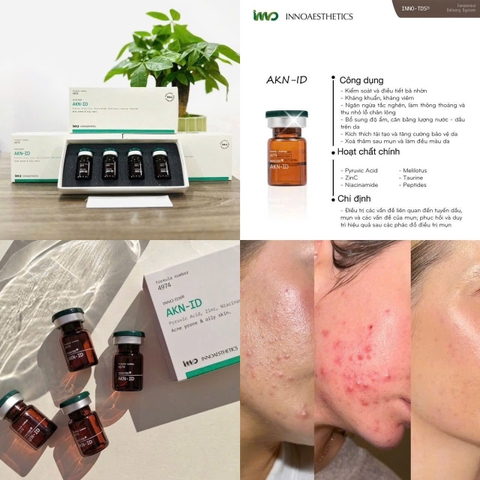 INNOAESTHETICS AKN-ID: Mesotherapy Đặc Trị Mụn và Da Dầu Hàng Đầu Châu Âu