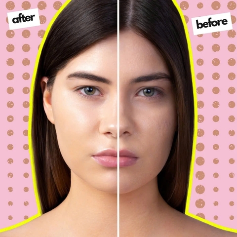 Synergy Therm BB Cream SPF 25 Light/Medium: Kem Nền Đa Năng Cho Lớp Nền Hoàn Hảo Tự Nhiên