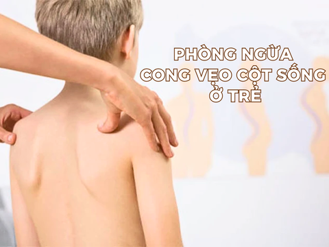 Phòng Ngừa Cong Vẹo Cột Sống Ở Trẻ