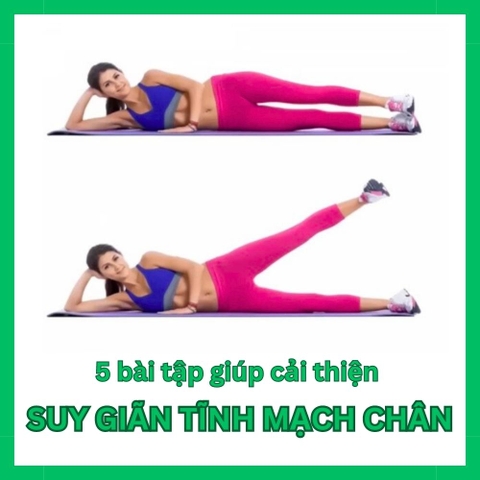 Cho người suy giãn tĩnh mạch chân: 5 bài tập đơn giản dễ dàng thực hiện ngay tại nhà hoặc văn phòng