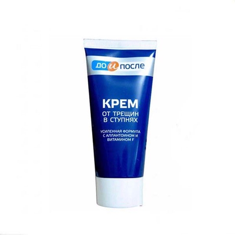 Kem Tay KPEM Trị Đồi Mồi, Vết Nám, Sạm, Đốm Nâu Da Tay