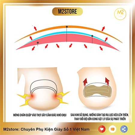 Miếng Dán Điều Chỉnh, Hỗ Trợ Móng Chân Mọc Ngược Tiện Dụng XIMO MD02