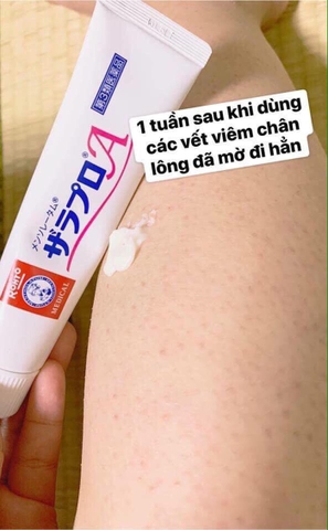 Kem Viêm Nang Lông Rohto Zaraporo 35g Nhật Bản