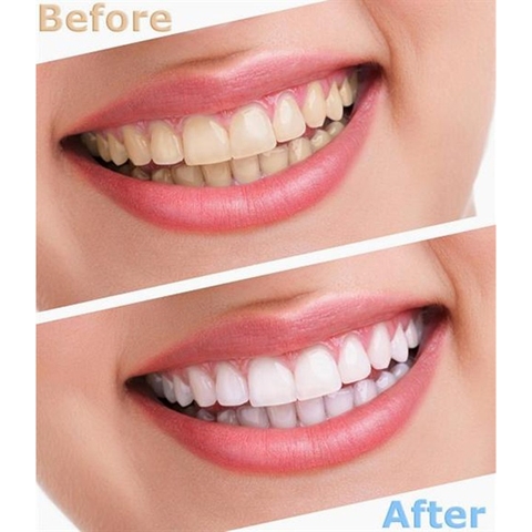 Combo BỘT + KEM đánh tẩy trắng răng Eucryl Anh Quốc