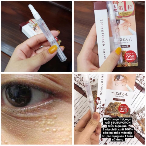 Kem Trị Mụn Thịt Mụn Gạo, Kem Xóa Nốt Ruồi Tsubuporon Nhật Bản 20g