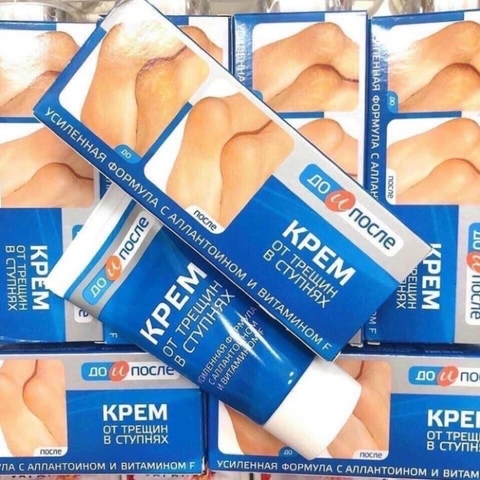 Kem Hỗ Trợ Cải Thiện Nứt Gót Chân Kpem Apteka 50ml Nga
