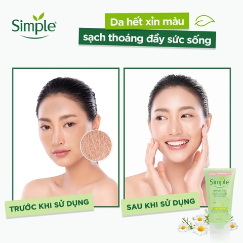 Sữa Rửa Mặt Dạng Gel Simple Dành Cho Da Nhạy Cảm Kind To Skin Refreshing Facial Wash Gel 150ml