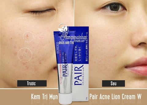 Kem Trị Mụn Pair Acne Lion Cream W 24g Nhật Bản