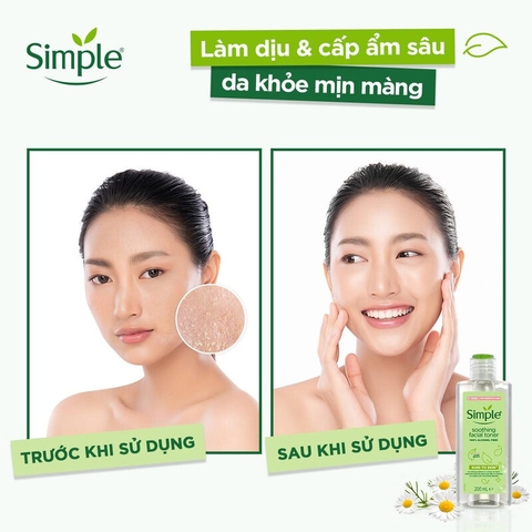 Nước Hoa Hồng Không Cồn Làm Dịu Da Simple Kind To Skin Soothing Facial Toner 200ml
