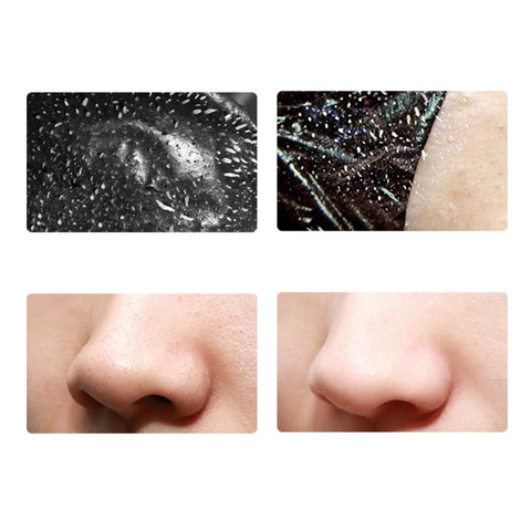 Mặt Nạ Gel Lột Mụn Đầu Đen Cho Mũi & Mặt Làm Sạch Mụn Cám, Bụi Bẩn, Lông Tơ Trên Mặt
