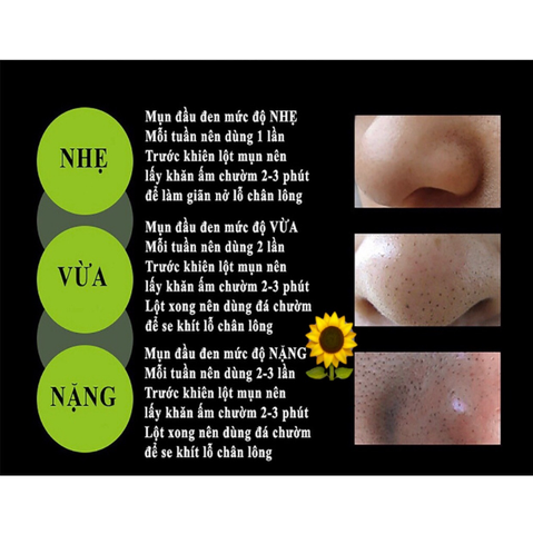 Tuýp Gel Lột Mụn Đầu Đen Than Tre Hoạt Tính Bioaqua 60g Sạch Mụn Đầu Đen