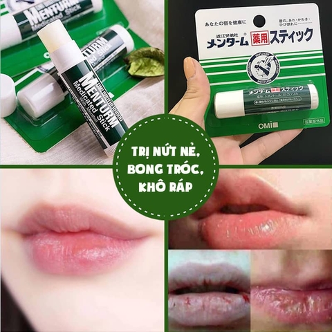 Son Dưỡng Omi Brotherhood Menturm Medicated Stick With Menthol Nhật Bản 4g - Dành Cho Môi Khô Và Nứt Nẻ
