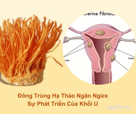 Lưu Ý U Xơ Có Uống Được Đông Trùng Hạ Thảo Không?