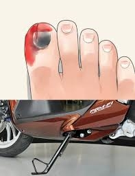 Ốp cao su lót chân chống xe máy dây rút chống trầy nền