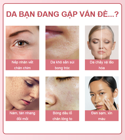 Combo đêm serum 50ml + kem dưỡng ốc sên đen 50ml