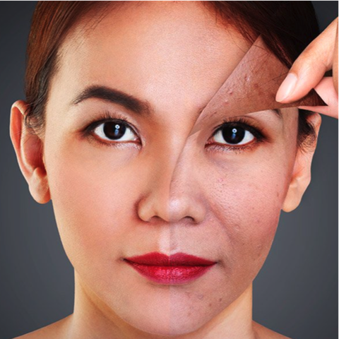 Liệu Trình Nuôi Cấy Collagen Tầng Sâu