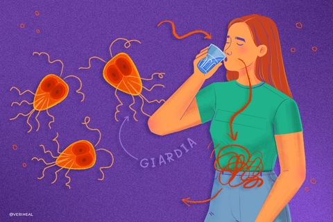 Nhiễm Giardia: Bệnh ký sinh trùng đường ruột phổ biến dễ mắc nhưng khó nhận biết