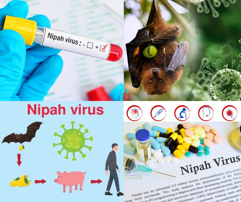 Virus Nipah là gì? Mức độ nguy hiểm và những điều cần biết để phòng tránh