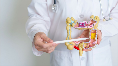 Phân Biệt Hội Chứng Ruột Kích Thích Và Viêm Đại Tràng: Đừng Nhầm Lẫn