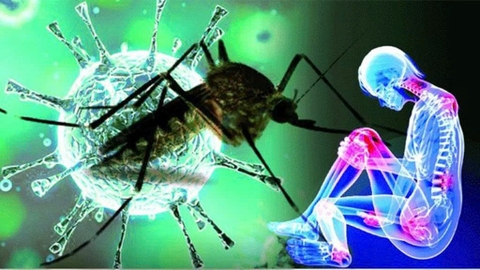 Bệnh Chikungunya: Nguyên nhân, triệu chứng, cách điều trị và phòng ngừa hiệu quả