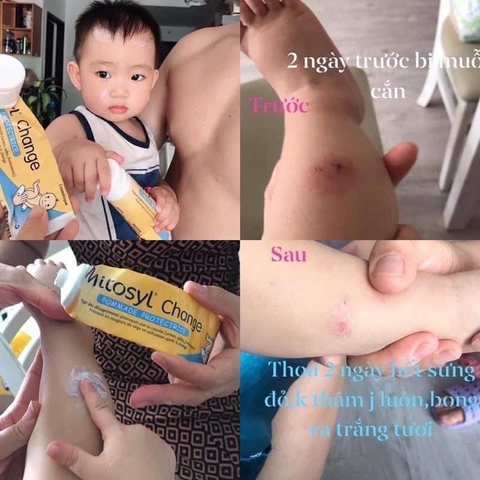 Kem Đa Năng Mitosyl Change Protective Ointment